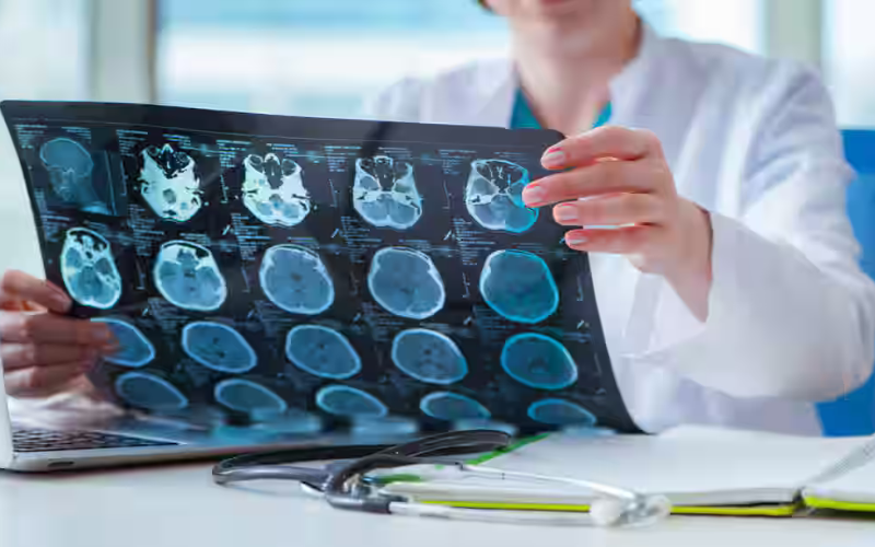 Neurology Department